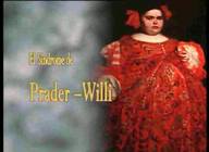 Síndrome de Prader-Willi 