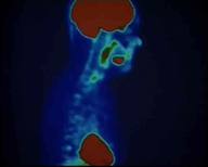 Innovaciones en Cáncer