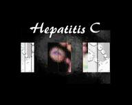 Hepatitis C