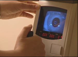 Cirugía refractiva para Oftamología y Optometría