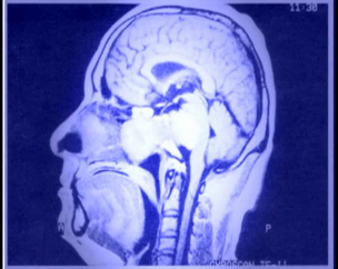 Premio Nobel de Medicina 2003. Paul Lauterbur - Peter Mansfield